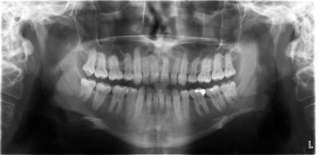 Röntgen in der Zahnklinik Ungarn